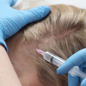 Прием ведёт МУХАМЕТЗЯНОВА ТАТЬЯНА ЭРИКОВНА врач косметолог, трихолог