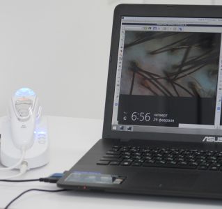 Трихоскоп диагностирует болезни волос и кожи головы