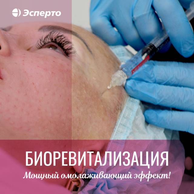 Биоревитализация в клинике «Эсперто»