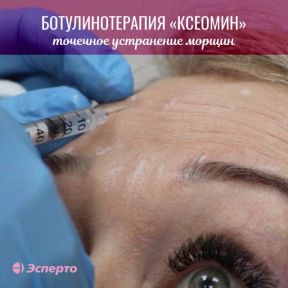 Точечное устранение морщин препаратом Ксеомин