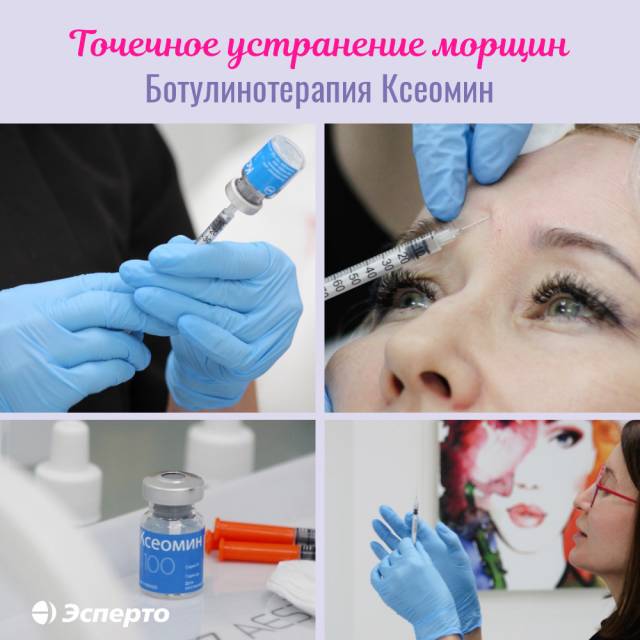 Ботулинотерапия Ксеомин в «Эсперто» — точечное устранение морщин