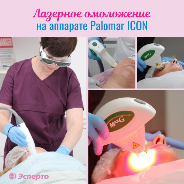 Лазерное омоложение на аппарате Palomar!