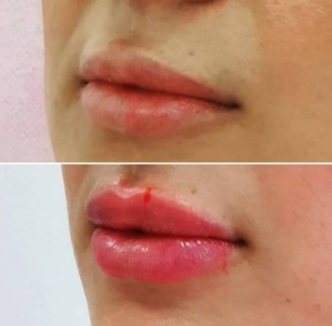 Наши врачи - косметологи дарят красоту!