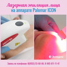 Лазерная эпиляция лица на аппарате PALOMAR ICON