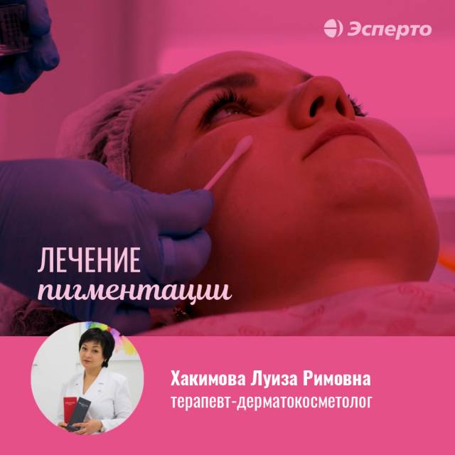 Лечение пигментации в клинике «Эсперто»