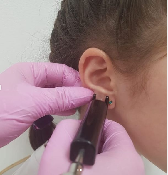 Прокол ушей в клинике «Эсперто»