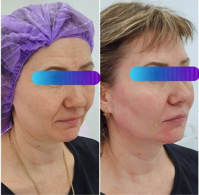 Вы только посмотрите - ОТЛИЧНЫЙ РЕЗУЛЬТАТ!