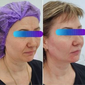 Вы только посмотрите - ОТЛИЧНЫЙ РЕЗУЛЬТАТ!