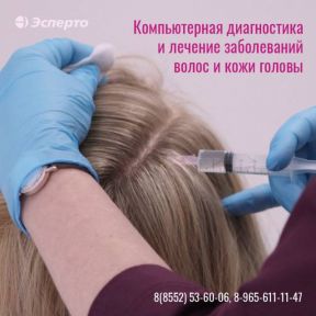 Компьютерная диагностика и лечение заболеваний волос и кожи головы