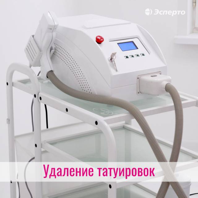 Как вывести татуировку?