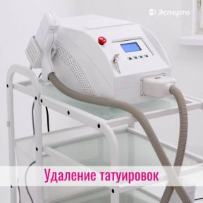 Как вывести татуировку?