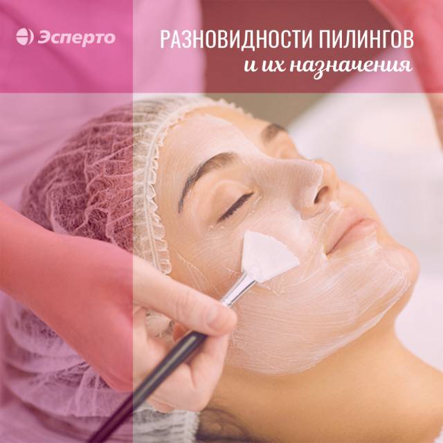 Разновидности пилингов в клинике «Эсперто»