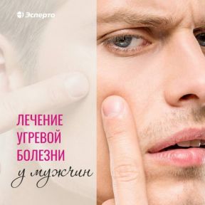 Лечение угревой болезни у мужчин